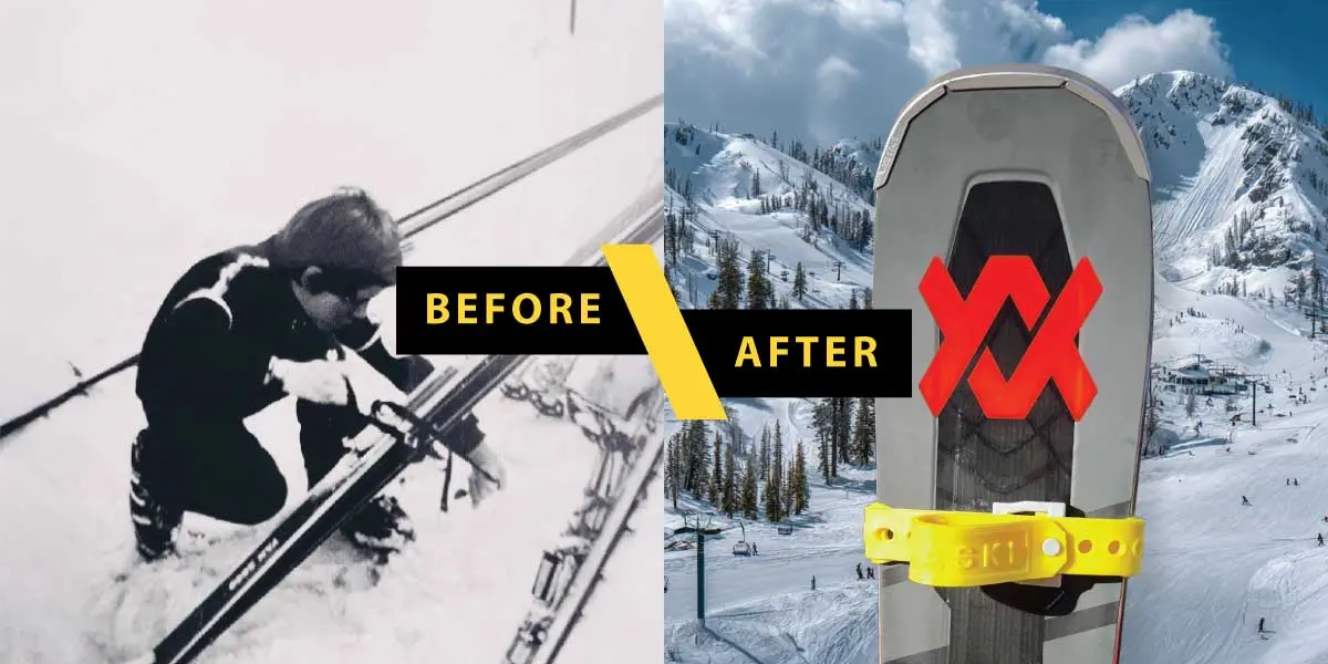 Before and After